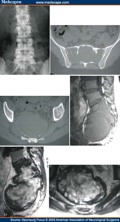 upper right back pain when circulatory