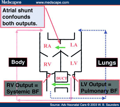 Lung Blood Flow