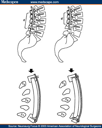 Caudal Rostral Definition