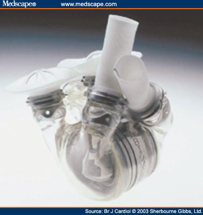 Total Artificial Heart