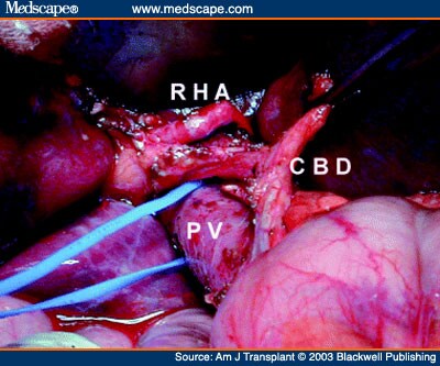 common bile duct diagram. dresses and the common bile