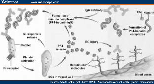 Pathophysiology of HIT.