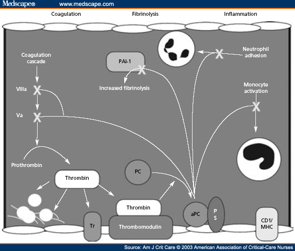 Sepsis Pathophysiology Diagram