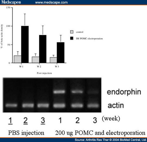 differences between dna and rna. RNA levels of β-endorphin were