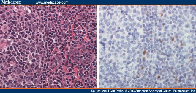 Tonsil Follicle