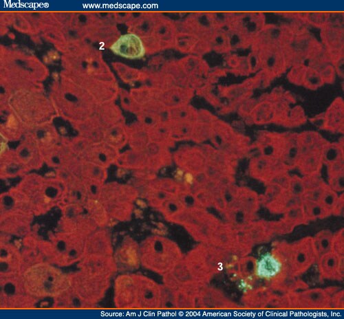 Cytokeratin Immunofluorescence