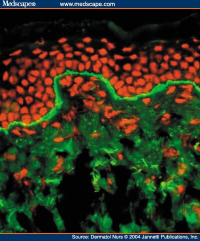 Linear Immunofluorescence