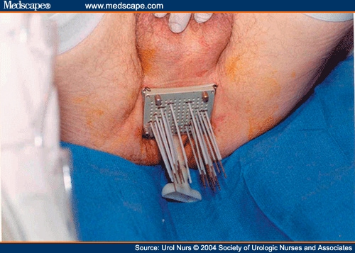 medscape.com medscape.com