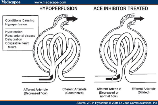 of settings wherein angiotensin converting enzyme ace inhibitor ...