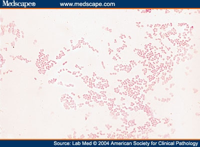  Macconkey on Misleading Gram Stain Findings On A Smear From A Cerebrospinal Fluid