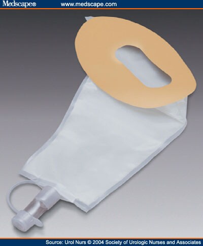 external incontinence devices catheter female condom pouch hollister bioderm courtesy elderly figure medscape