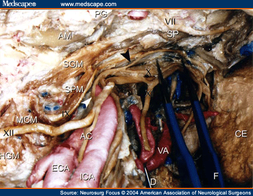 Nervus Hypoglossus