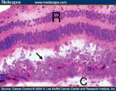 Bruch Membrane