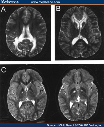 mri brain scan. Conventional Brain MRI