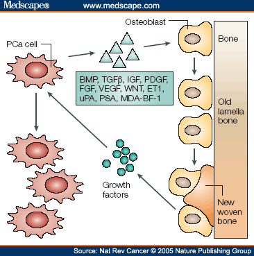 cancer cells pictures. Prostate cancer cell and