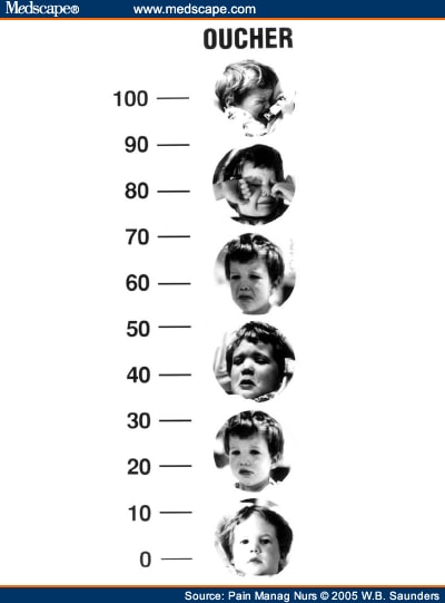 oucher pain scale