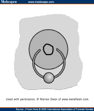 Horizontal nipple with barbell. b. Horizontal nipple with capture head.