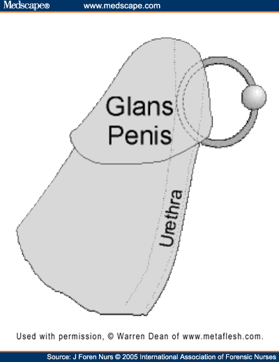 genitial piercing. Male Genital Piercings