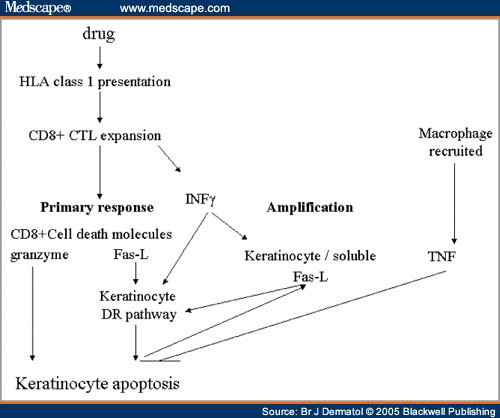 Toxic Epidermal Necrolysis. toxic epidermal necrolysis