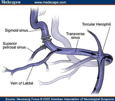 Sinus Venous