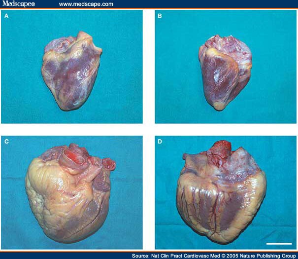 Heart With Fat 65