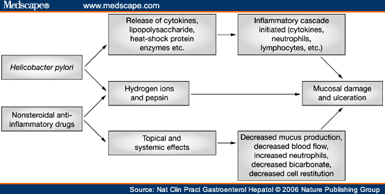 Nsaid Ulcer