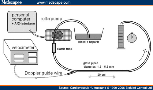 Turbulent Flow as a Cause for laminar and turbulent flow. Turbulent Flow as a Cause for