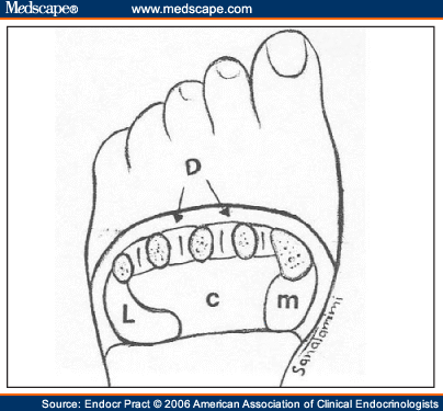 soft tissue cyst foot icd 10