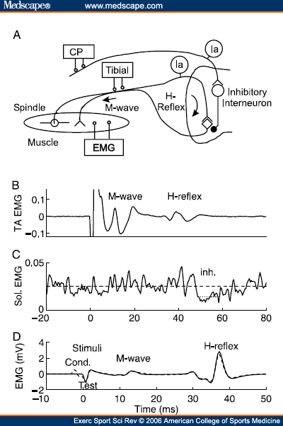 Emg Waves