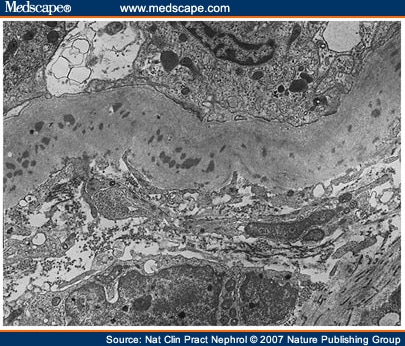 Tubular Epithelium