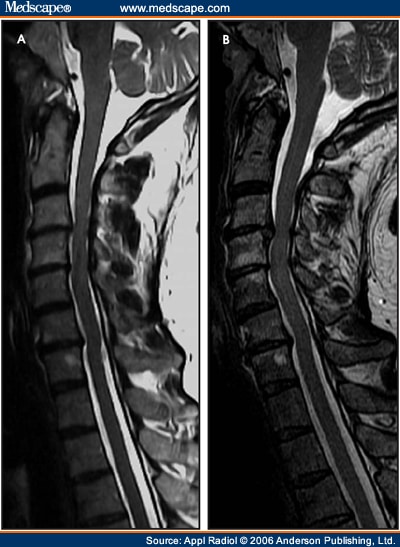 Clinical 3T MRI: Mastering The Challenges