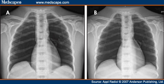 Digital Radiography Quality Assurance: A Technique For Standardizing Image