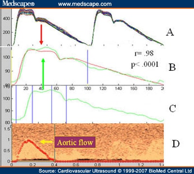 Aortic Flow