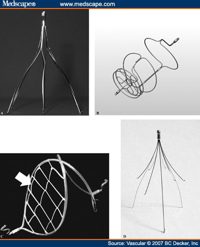 Optional Vena Cava Filters: What, Why, and When: Abstract and Introduction