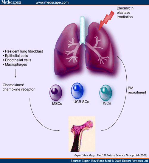 damaged lungs. to the damaged lung.