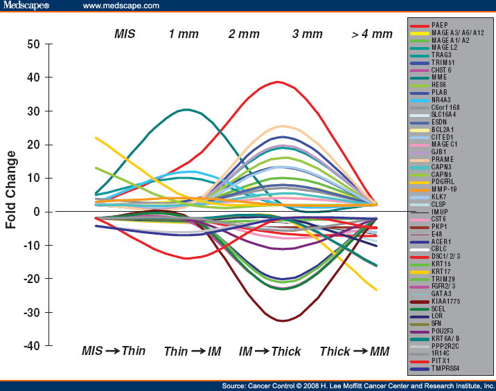 melanoma progression