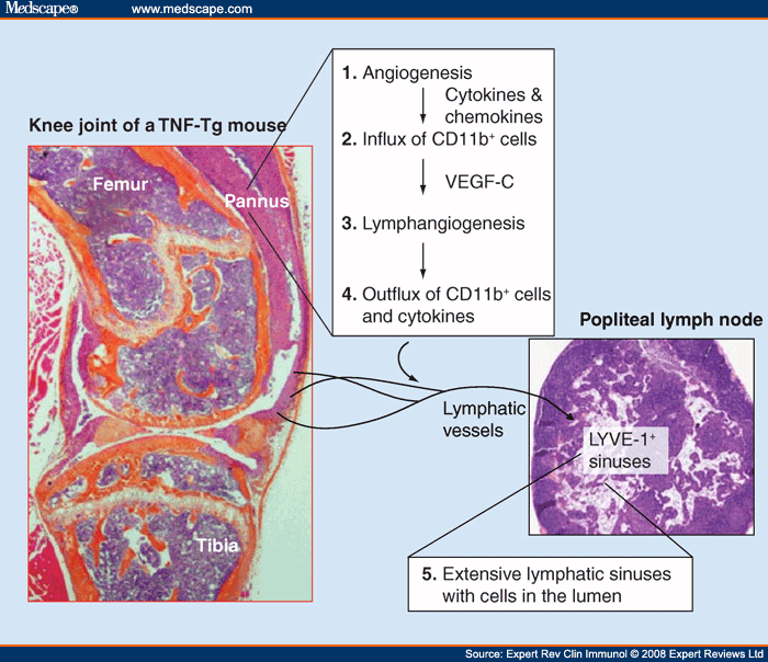 Ra Pannus