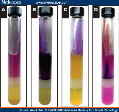 Urea Agar