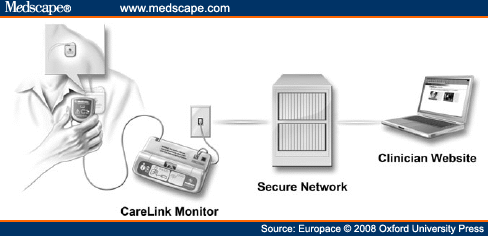 Medtronic CareLink