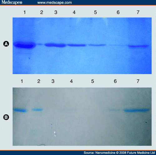 15+sds+page+gel