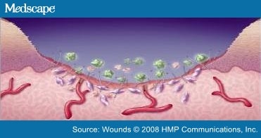 A Review of Collagen and Collagen-based Wound Dressings: Abstract ... A Review of Collagen and Collagen-based Wound Dressings: Abstract ...