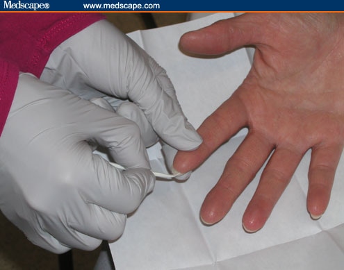 evidence forensic hair fingernails fibers scraping nurses scrapings fiber under forensics paper collect physical nursing hairs struggle hand figure separate