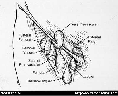 Myopectineal Orifice Anatomy