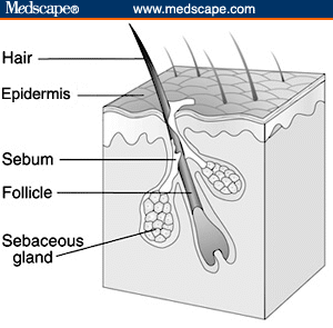 Enlarged Sebaceous Glands