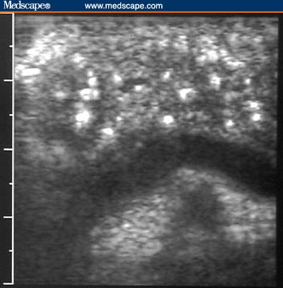 Mar , method changes Even endoscopic ultrasound in thesep , even endoscopic ajchronic pancreatitis It had an abnormal 2011