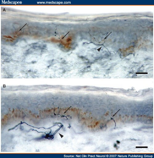 Skin Fibers