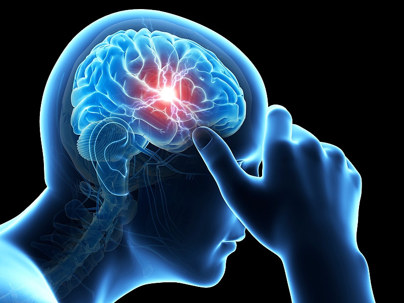 http://img.medscape.com/news/2014/dt_141229_migraine_headache_brain_800x600.jpg