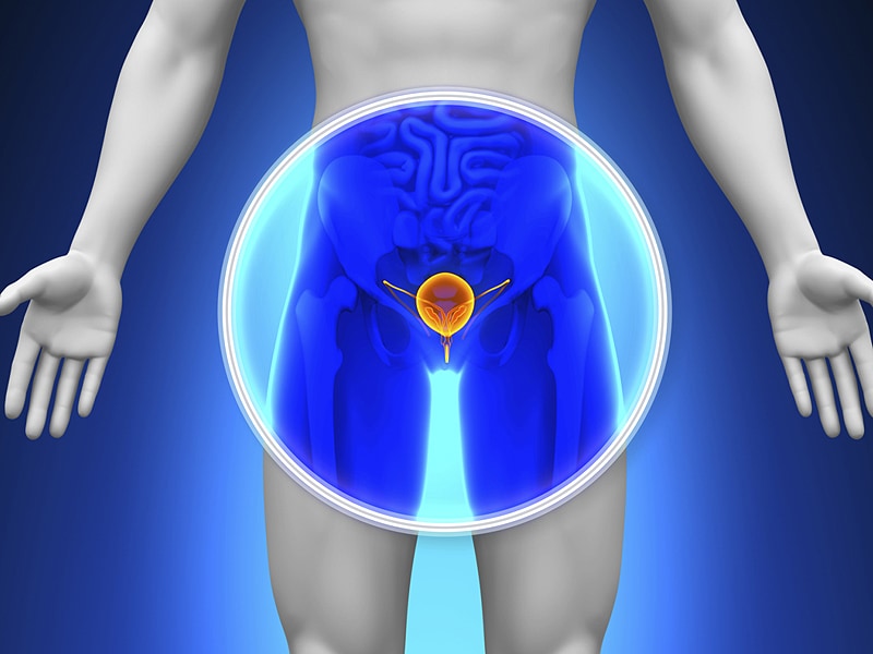 More men at risk for prostate cancer as a result of less regular screening