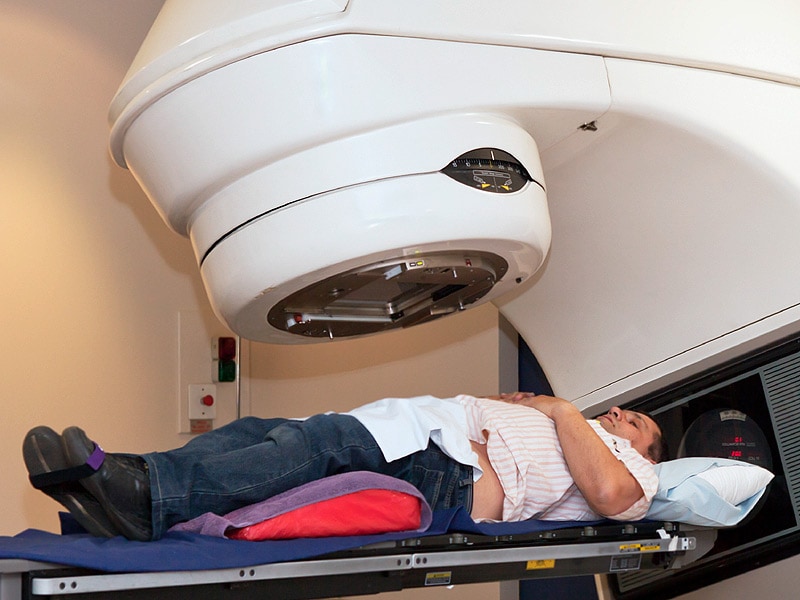 Radiation vs CRT Equally Effective for Reducing Dysphagia