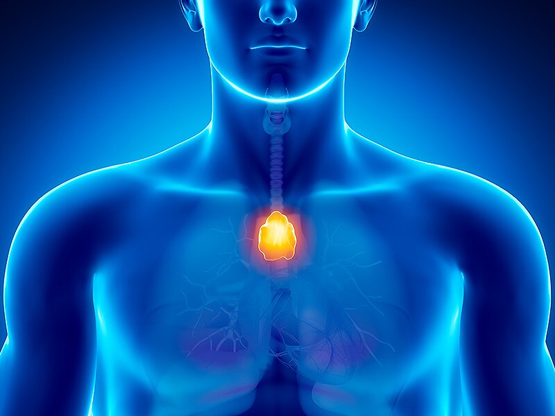 Sunitinib Active in Advanced Thymic Carcinoma